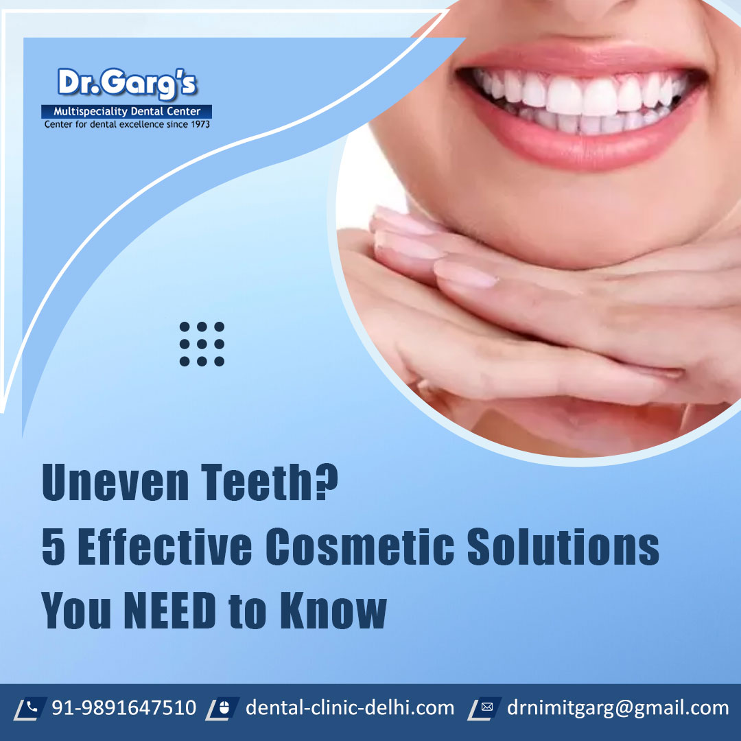 Uneven Teeth? 5 Effective Cosmetic Solutions You NEED to Know | Our...